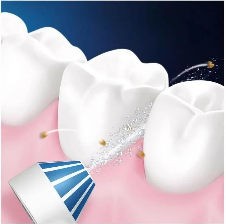 Irigator dhëmbësh Oral-B OxyJet MD20, i bardhë