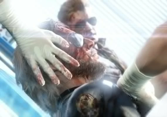 Metal Gear Solid V - The Definitive Experience Pack DLC EN Global