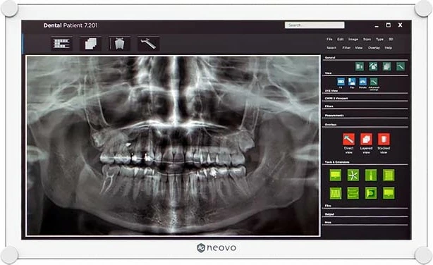 Monitor AG Neovo DR-2202 21.5 inç FHD 1920x1080 i bardhë