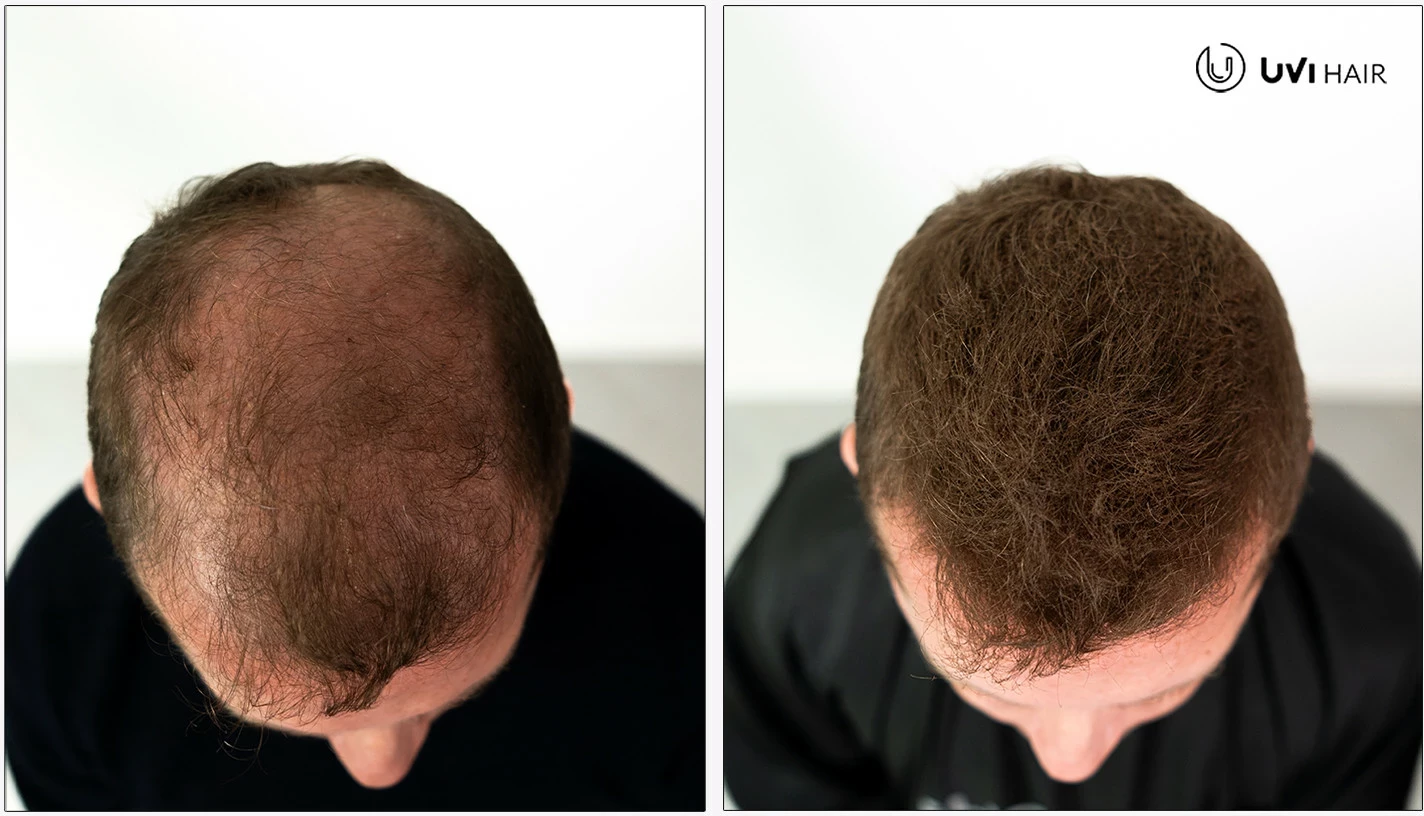 Fibra për flokë UVI Hair 27.5 g (deri 50 aplikime), Auburn