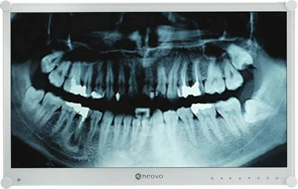 Monitor dental AG Neovo DR-24G, 23.8", Full HD, LCD, Bardhë