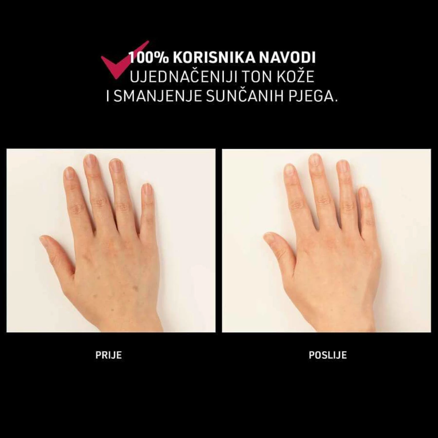 Maskë LED anti-aging për duar FAQ 221, 8 valëgjatësi, 623 pika LED, e rikarikueshme USB, pa kabllo, me aplikacion