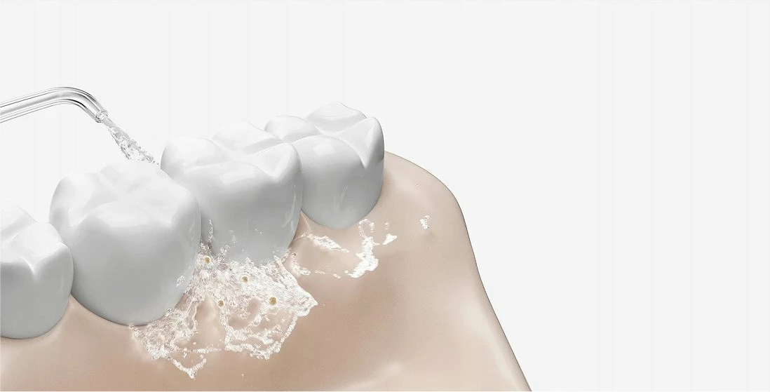Irigator dentar Xiaomi Water Flosser 2, 200 ml, 3 moda, me bateri, 2 maja, i bardhë